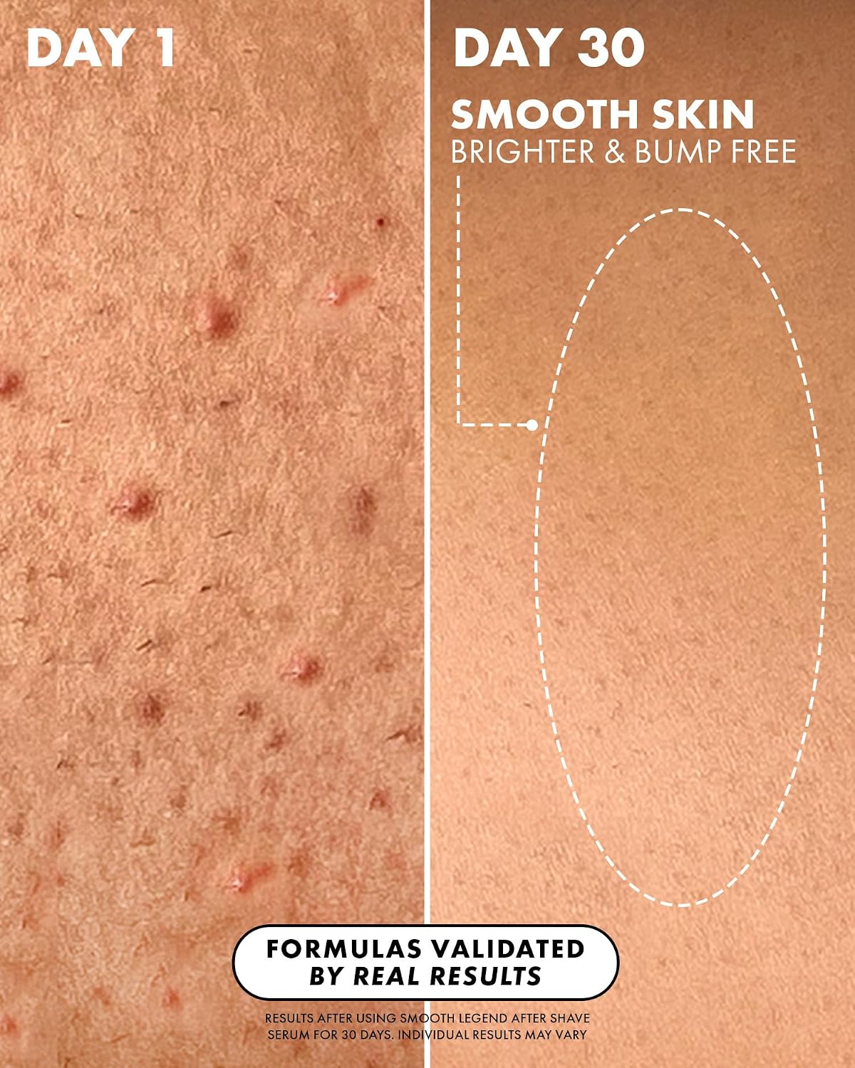 SERUM AFTER SHAVE TRULY